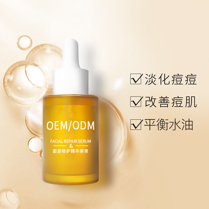 桃园县_祛痘精华原液OEM